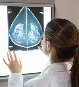 female doctor examining mammogram results