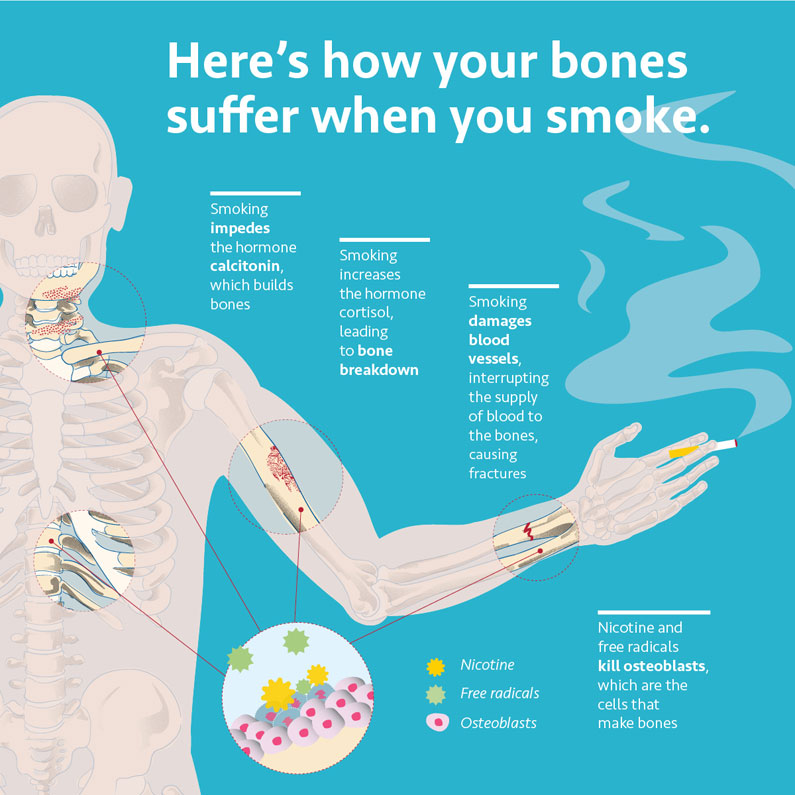 smoking and bone health infographic