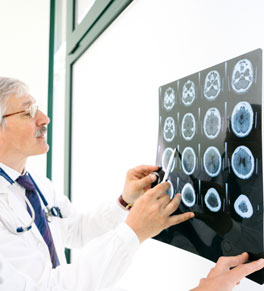 doctors looking at brain scans