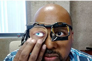 Dr. Ian Harris demonstates the digital eye prosthetic that mimics the natural movement of the eye.