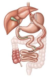 RouxenyGastricBypass