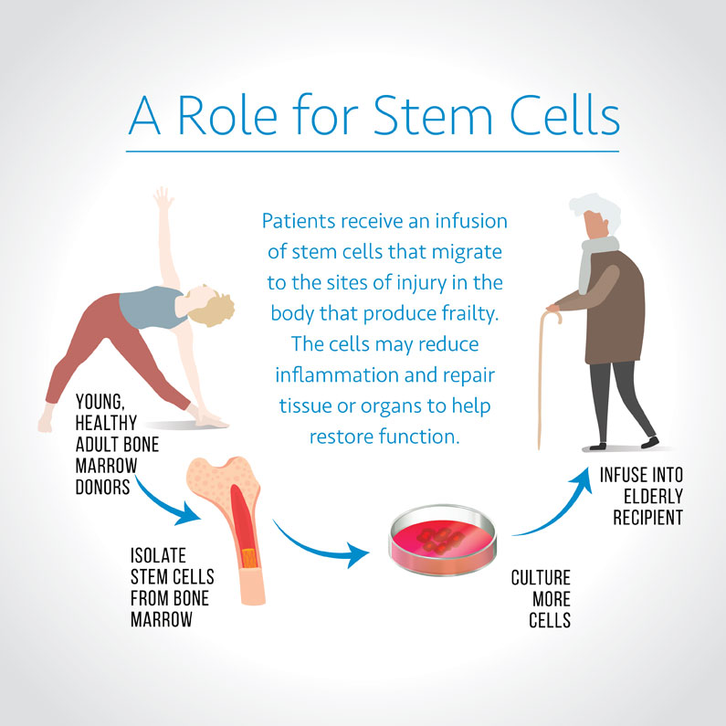 frailty stem cell infographic