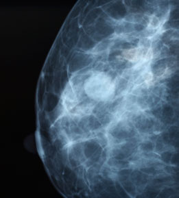 breastmammogram261