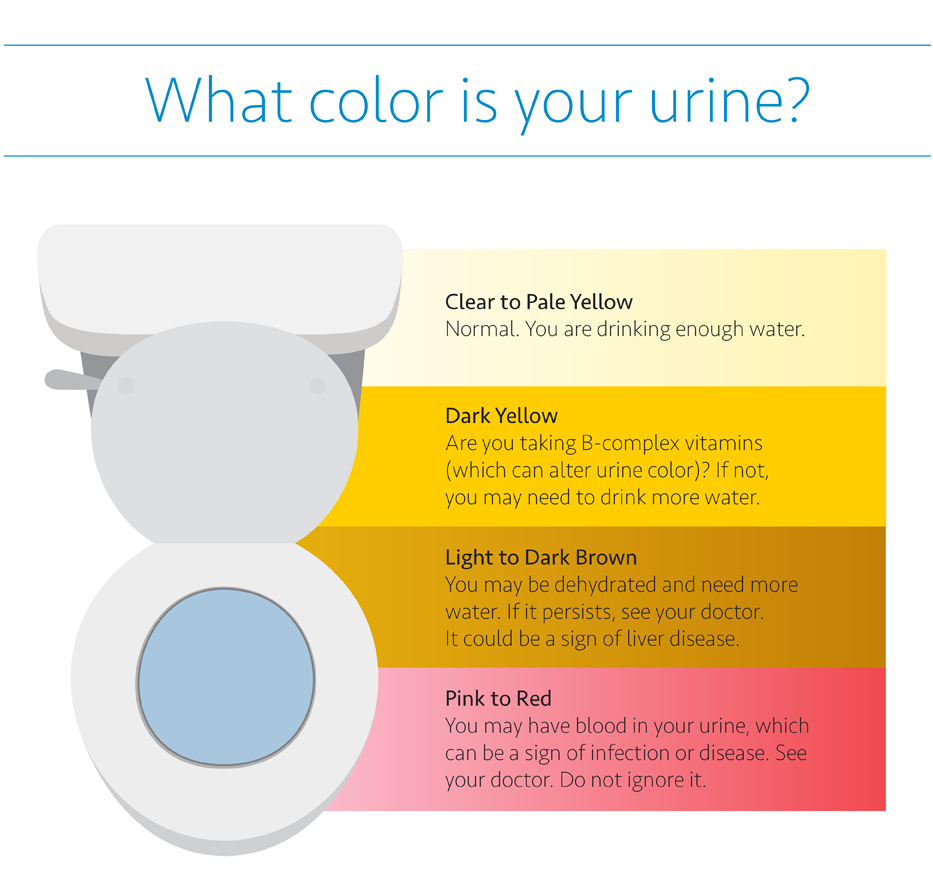 Urine Color Chart Infection