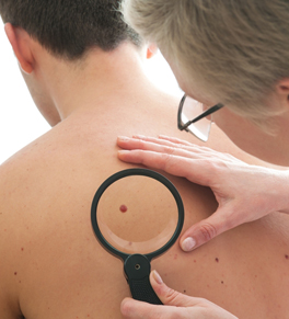 dermatologist examining mole on man's back