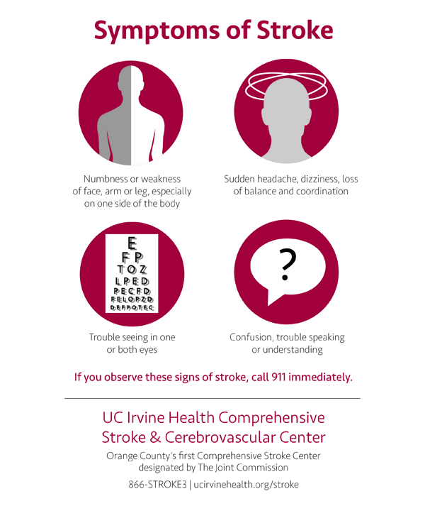 signs of stroke infographic
