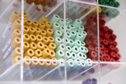 vials for blood draws and lab testing