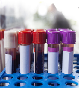 What do your lab test results mean? | UCI Health | Orange County, CA