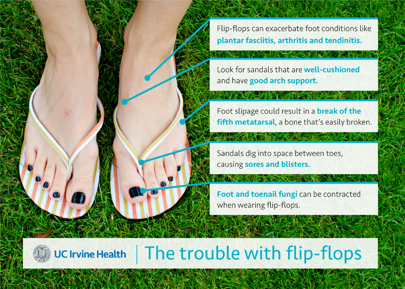 the trouble with flip flops infographic 