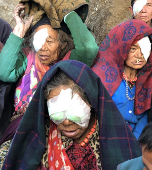 nepalese women after cataract surgery