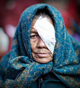 woman after cataract surgery nepal