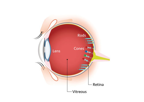 retinitis pigmentosa infographic