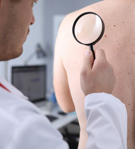 doctor checking transplant patient for skin cancer with magnifying glass