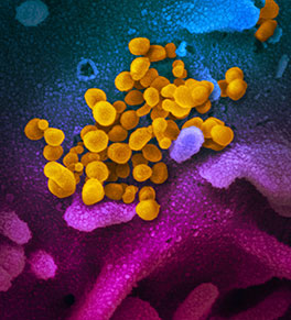 Scanning electron microscope image of the novel coronavirus cells (yellow) emerging from a laboratory culture medium captured by NIAID's Rocky Mountain Laboratories in Montana. 