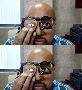 UCI professor Ian Harris demonstrates a digital prosthetic eye that can mimic the movements of the health eye.