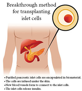 isletcells2_264x291_comp