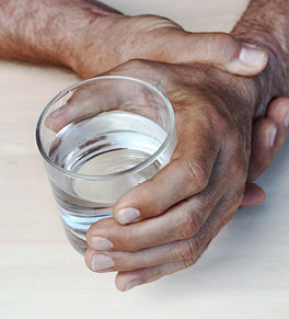 The hands of a man with Parkinson's disease tremble.