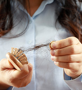 Alopecia areata can cause hair loss like the clump of hair this woman is pulling from her hairbrush.