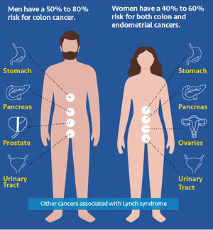 A blue graphic showing the cancers associated with Lynch syndrome.