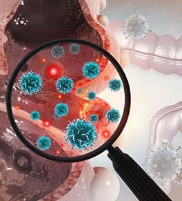 Concept illustration of cancer cells attacking the colon.