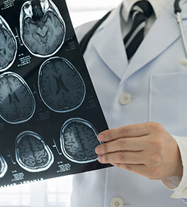 A doctor exmaines an MRI scn of a patient's brain.