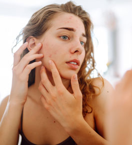 a woman with long wavy hair and acne examining her face in the mirror