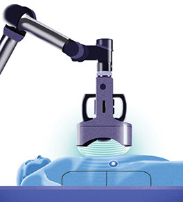 Illustration shows a device on a telescoping arm focusing high-energy sound waves on the liver of a patient lying on a blue treatment table.