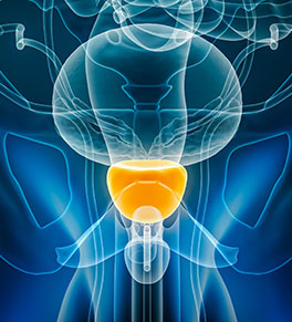 A front-view 3D X-ray shows a prostate gland, lit up in gold, located beneath the bladder and around the penis.