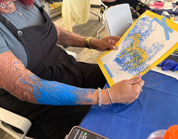 a uci health regional burn center scar burn workshop participant shows her artwork and her painted arm