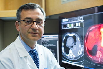 Mohsen Davoud, MD, UCI Health pulmonologist and lung cancer expert