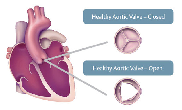healthy heart valve