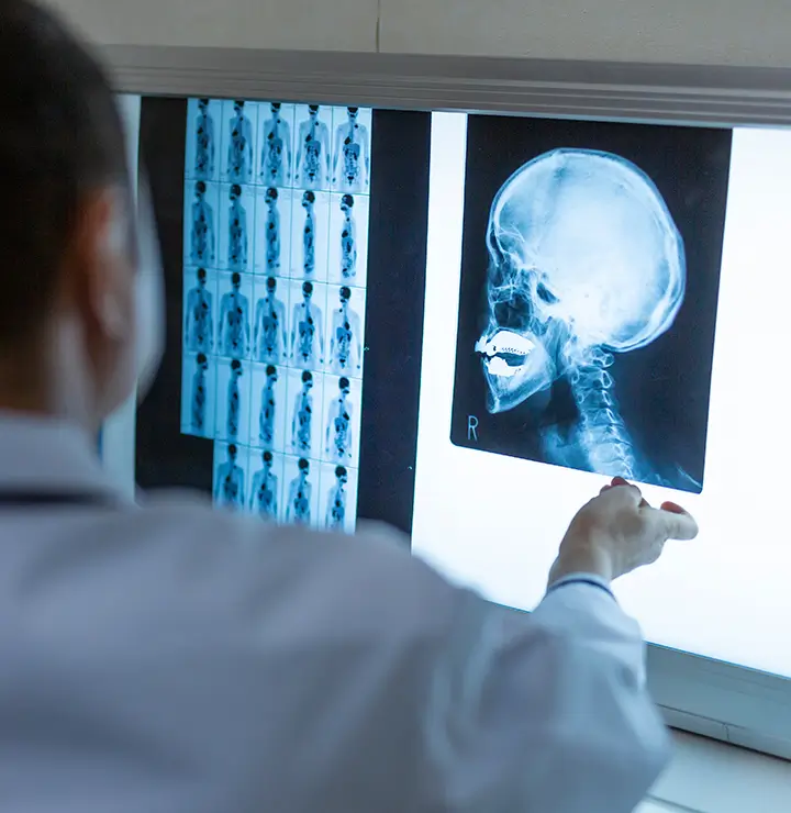 Doctor reviewing an X-ray of a skull and spine on a lightbox in a medical office.