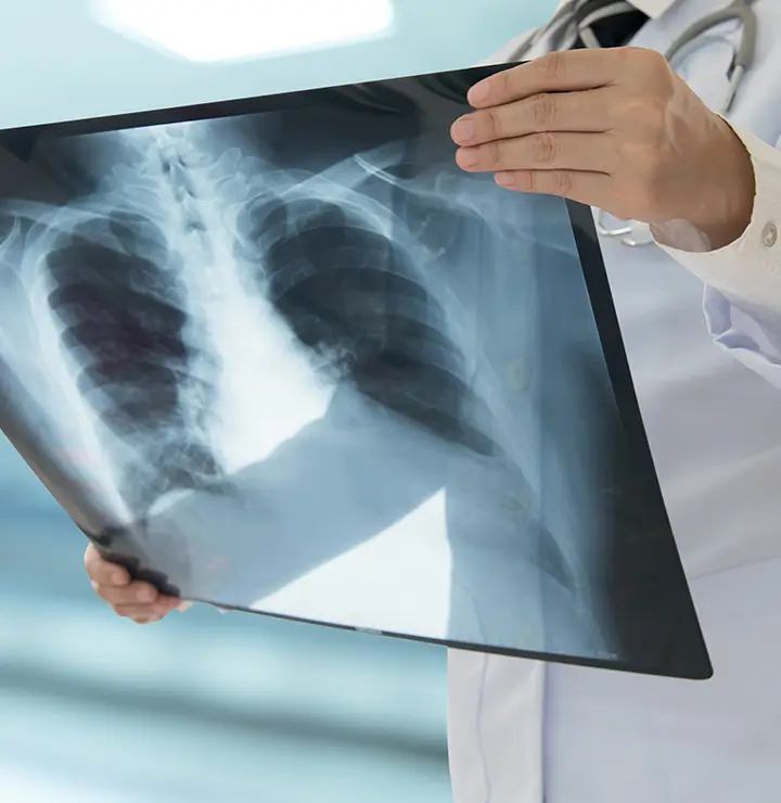 A doctor in a white coat examines a chest X-ray, assessing a patient's health in a blurred clinical setting.