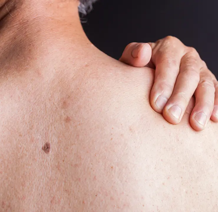 Close-up of a person touching their bare shoulder with their hand against a dark background.