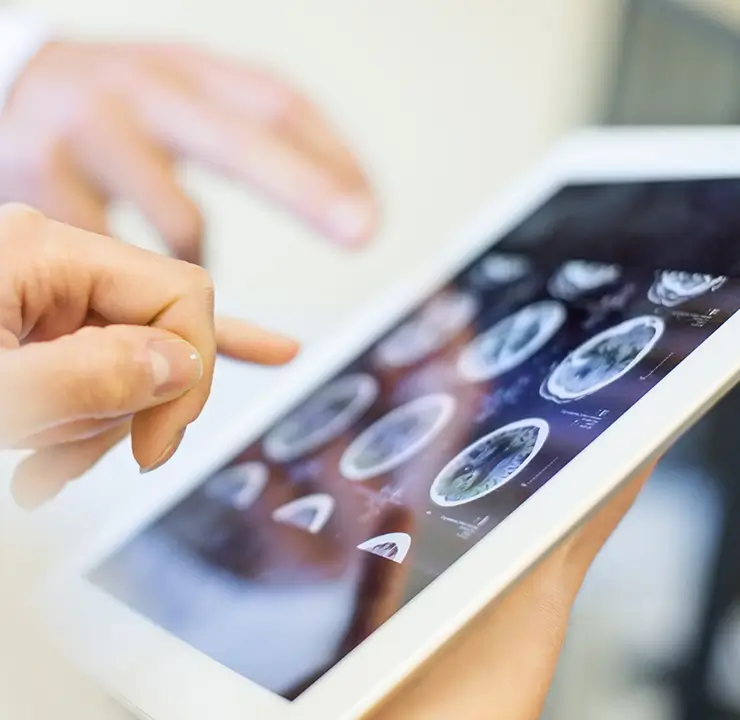 Close-up of a person using a tablet displaying medical images, with fingers pointing at the screen.