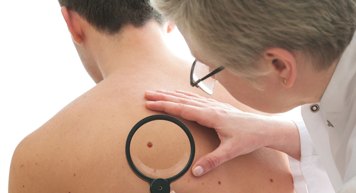 How melanoma evades the immune system